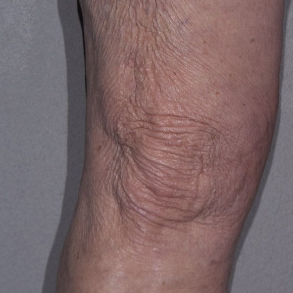 59% Change In the Appearance Of Elasticity After 12 Weeks Of Use