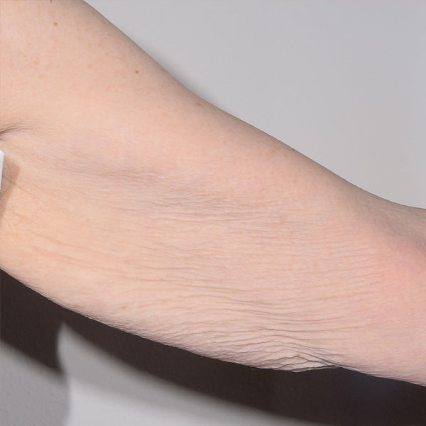 63% Reduction in the Appearance of Crepiness When Used as a Daily Skincare Treatment