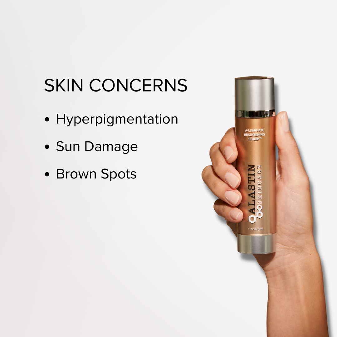 SKIN CONCERNS: Hyperpigmentation, Sun Damage, Brown Spots