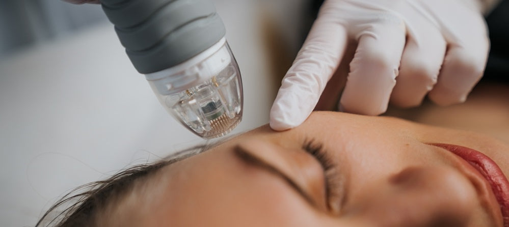 RF Microneedling