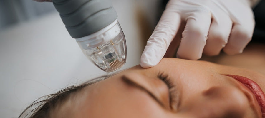 RF Microneedling