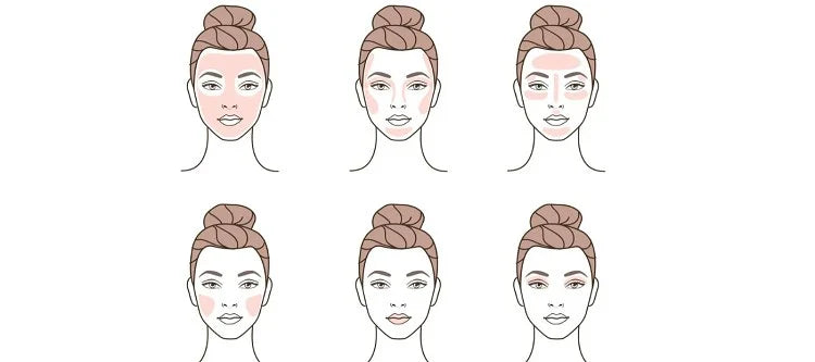 An illustration showing six facial diagrams highlighting common areas of skin purging on a woman's face.