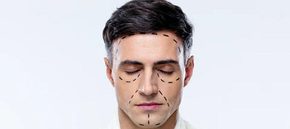 Man with cosmetic procedure markup on face