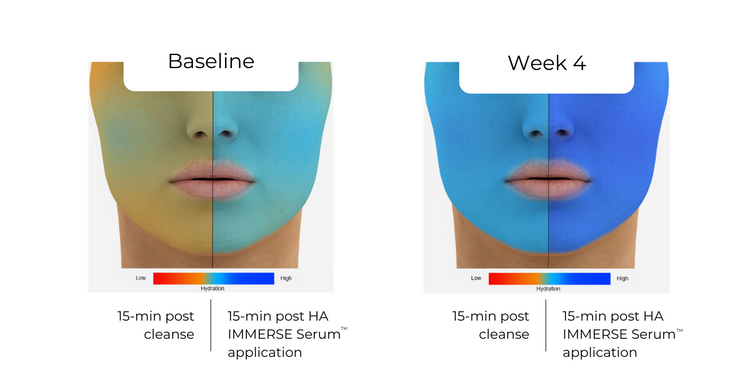 HA IMMERSE Serum™ | Hyaluronic Acid Serum | ALASTIN Skincare®